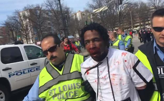Man with bloody face at St. Louis rally